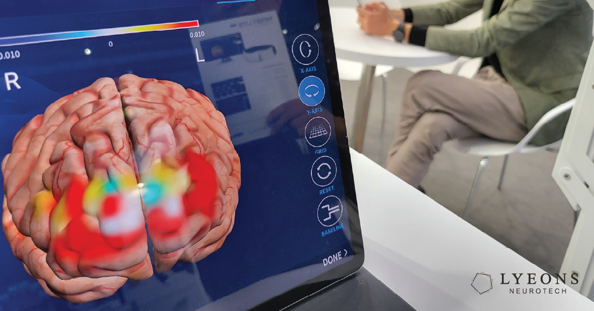 The Challenge of Switching Off for High-Functioning Individuals